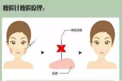 溶脂针副作用有哪些？