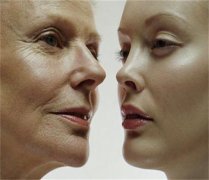 皱纹是女人的天敌，甩开它可以选择除皱针保养