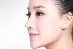 增高鼻梁的自然小妙招,你学会了吗?