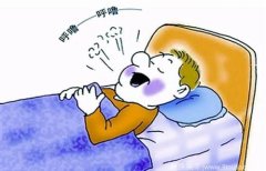 “打呼噜”与脑卒中
